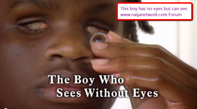 boy-see-without-eyes