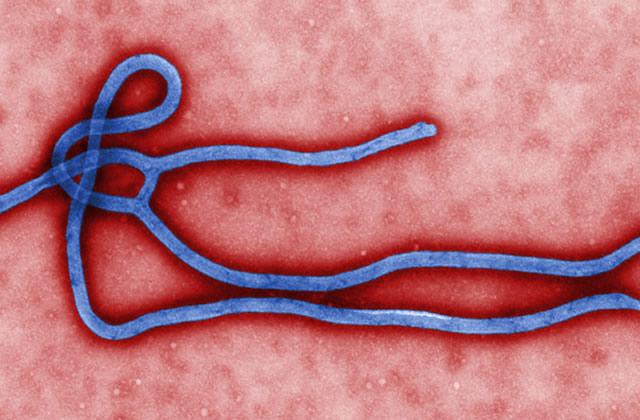 Ebola-virus